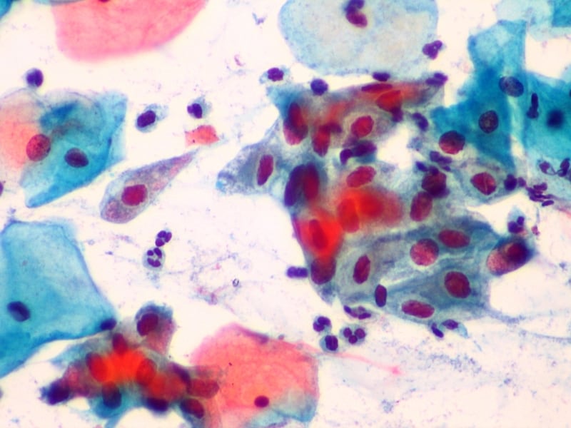 Onkologická cytologie 4 - Sanatorium Helios CZ Onkologická cytologie 3 - Sanatorium Helios CZ