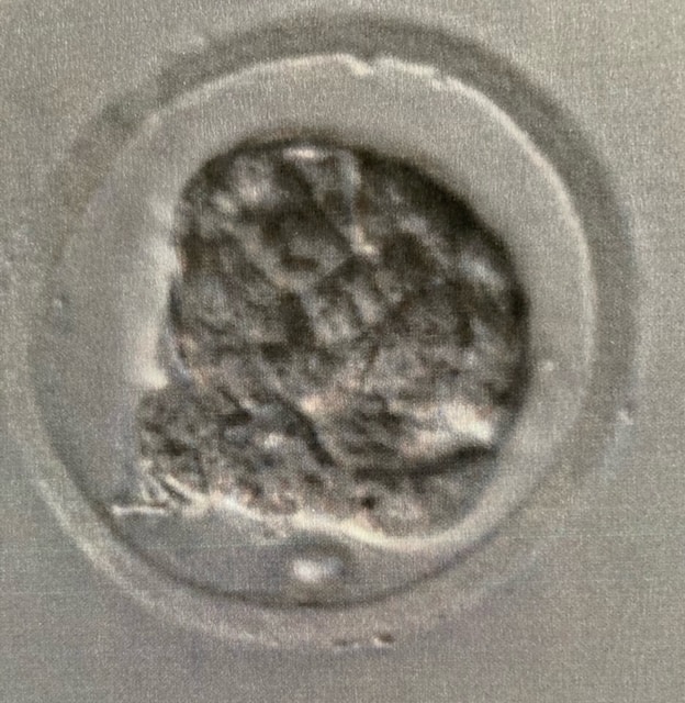 Přežilo embryo mražení? 3 - Sanatorium Helios CZ blastocysta
