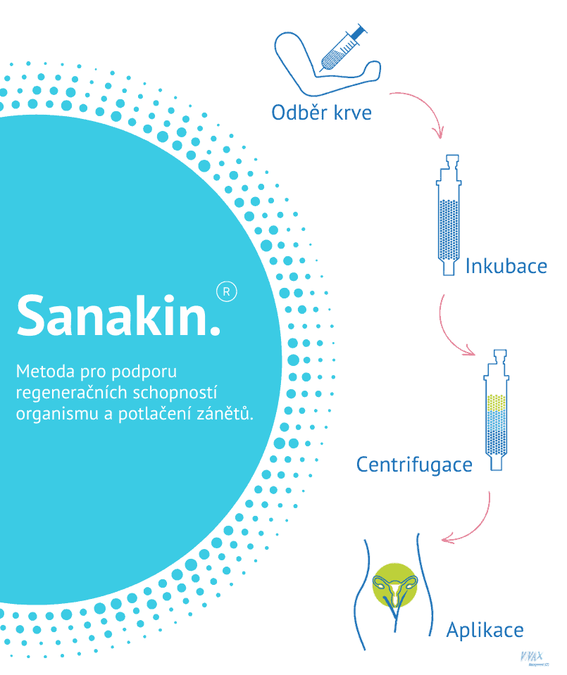 Sanakin® 2 - Sanatorium Helios CZ Sanakin® 1 - Sanatorium Helios CZ